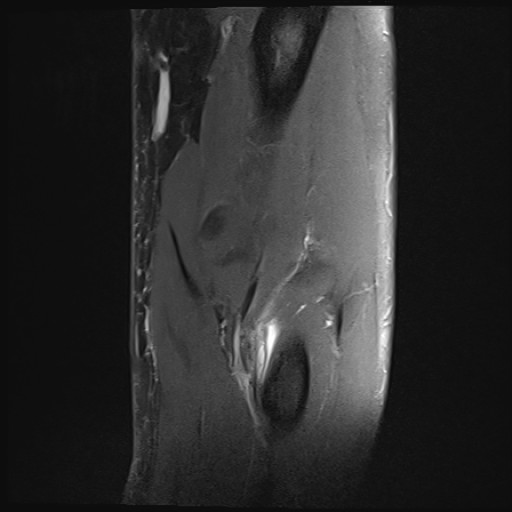 Click on the Serie image to view the images of Wieszt, Gnter